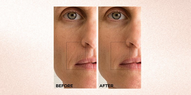 InArticlevitamincretinolhyaluronicacidroutineBA 03 Retinol Night Serum